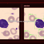 基于yolov8的血液细胞智能识别系统